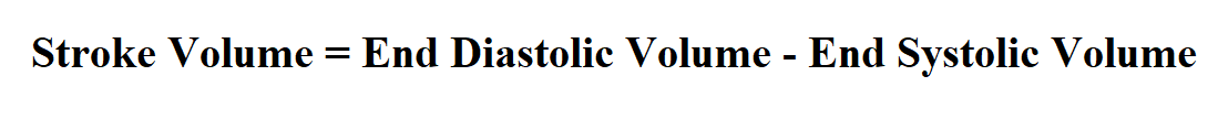 Stroke Volume Equation