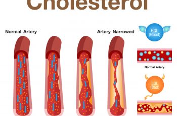 How to Calculate Total Cholesterol.