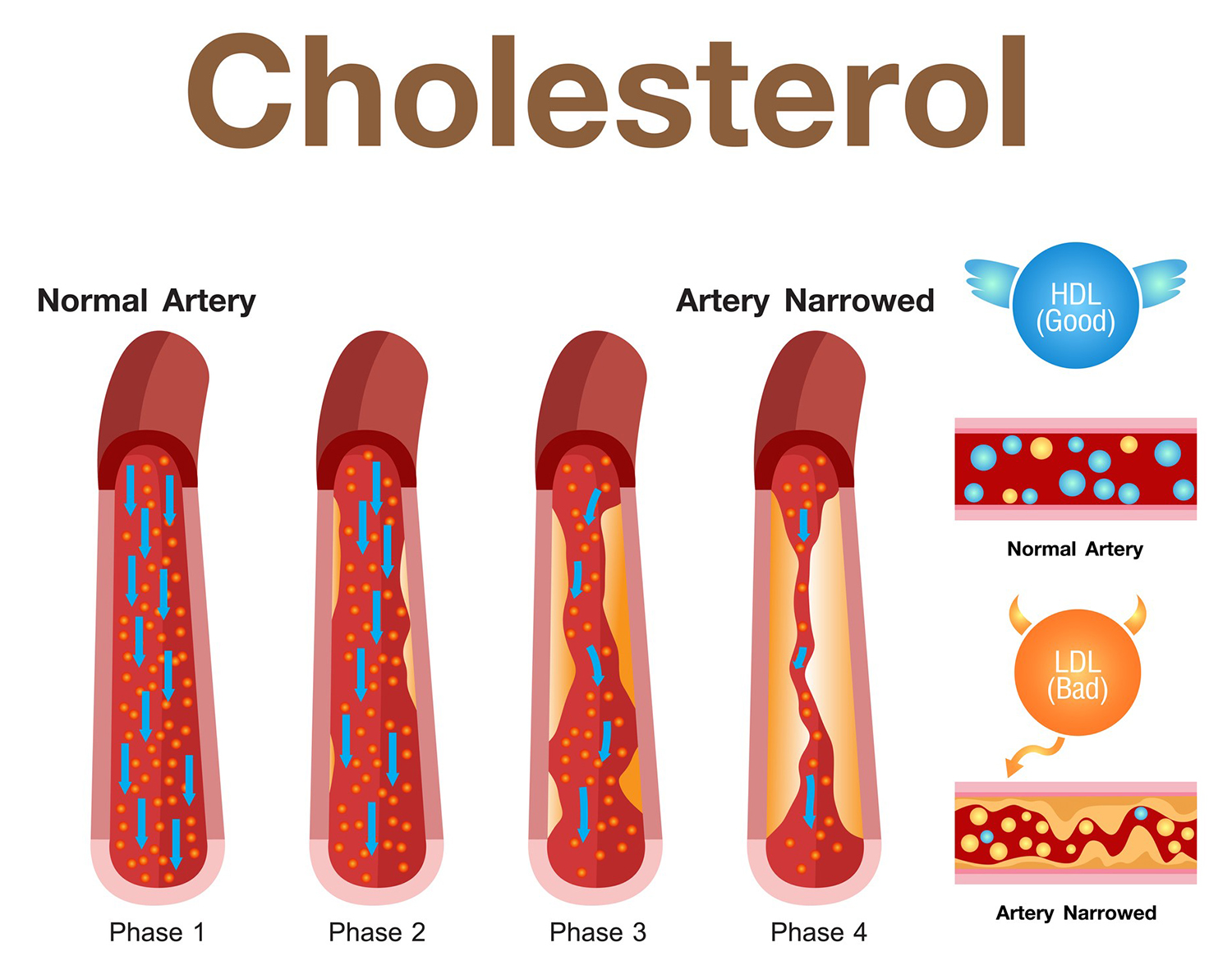 Colesterol bajo y cancer