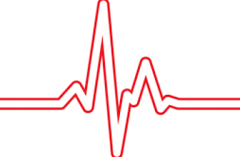 How to Calculate Heart Rate on ECG.