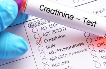 How to Calculate Creatinine Clearance.